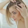 10 Essential Tips to Stop Hair Loss and Improve Hair Health