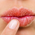 The Ultimate Guide to Avoiding Chapped Lips: Beauty and Health Tips from Dermatologists