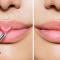 Beauty Hacks: How to Achieve the Perfect Lip Look