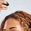 Say Goodbye to Dandruff with These Beauty Hacks