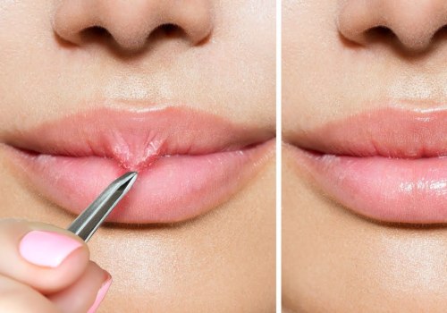 Beauty Hacks: How to Achieve the Perfect Lip Look