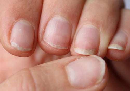 Beauty and Health Tips for Stronger Nails